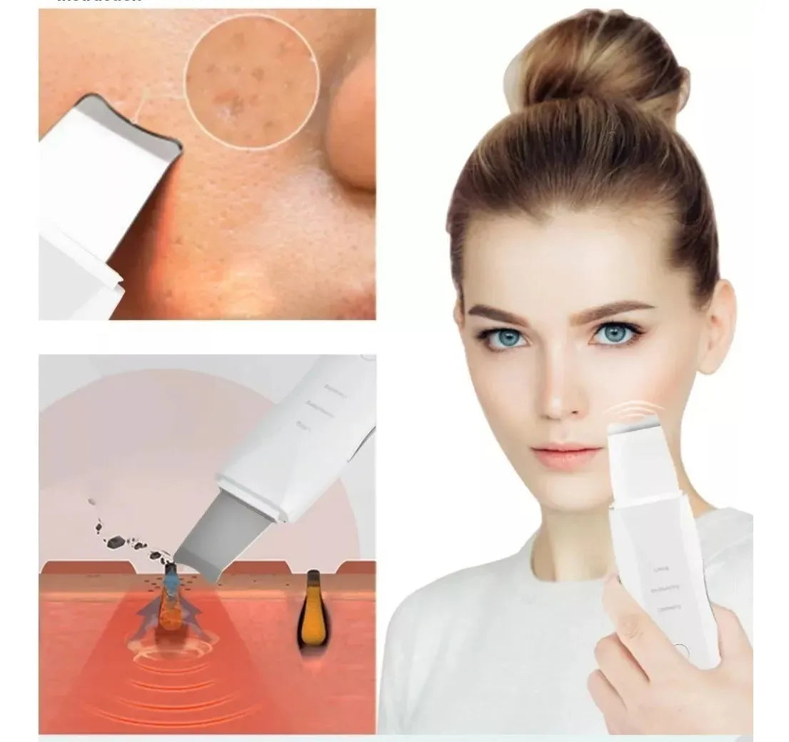 NUEVO LIMPIADOR ULTRASÓNICO FACIAL